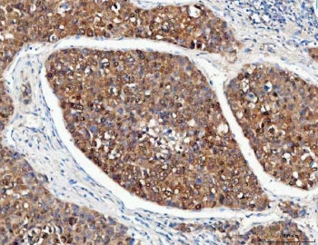 PSMD14 Antibody / 26S proteasome non-ATPase regulatory subunit 14