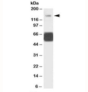 GRIK1 Antibody