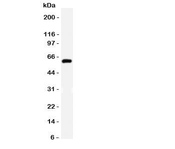HNF1B Antibody