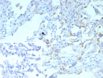 IHC staining of FFPE human lung tissue with Surfactant Protein D antibody (clone rSFTPD/8065). Inset