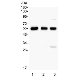 Western blot testing of 1) human HL60, 2) rat thymus and 3) mouse thymus with RUNX1 antibody. Predic