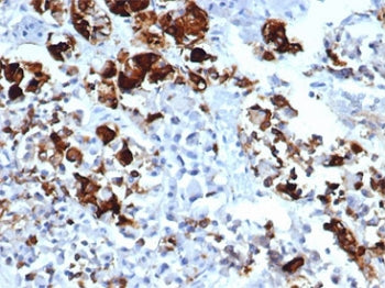 IHC staining of FFPE human pituitary tissue with recombinant PRL antibody (clone rPRL/4909). HIER: b