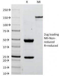 SDS-PAGE Analysis of Purified, BSA-Free Placental Alkaline Phosphatase Antibody (clone ALPP/238). Co