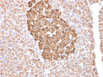 FTH1 Antibody / Ferritin heavy chain