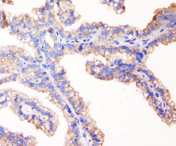 ZO-1 Antibody / TJP1