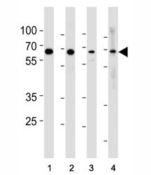 p65 Antibody (RELA)