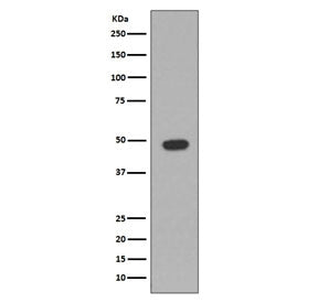 GFAP Antibody / Glial Fibrillary Acidic Protein