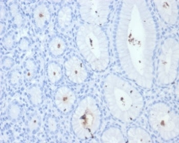 H pylori Antibody (Catalase)