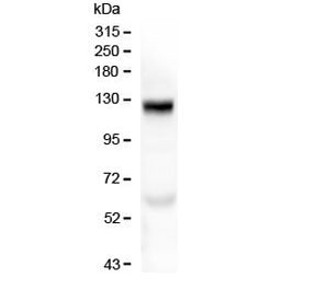 Western blot testing of human placenta with COL17A1 antibody at 0.5ug/ml. Expected molecular weight 