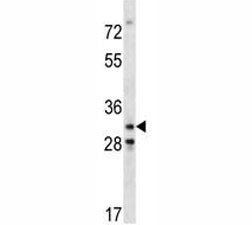 Cdk4 Antibody