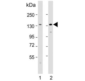 Western blot testing of human 1) A431 and 2) SH-SY5Y cell lysate with Cadherin 4 antibody. Expected 