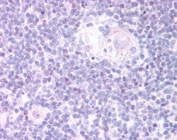 IHC testing of FFPE human thymus medulla with FOXN1 antibody at 20ug/ml. HIER: steamed with pH6 citr