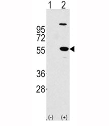Western blot analysis of ALDH1A1 antibody and 293 cell lysate (2 ug/lane) either nontransfected (Lan