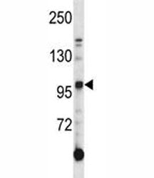 AXL antibody western blot analysis in K562 lysate. Predicted molecular weight is 104 kDa unglycosyla