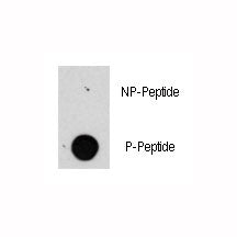 Raptor Antibody (phospho-S863)
