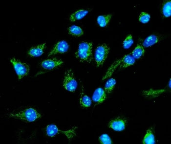 MTHFD1L Antibody