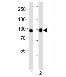 Western blot analysis of lysate from (1) A549 and (2) HeLa cell line using FGFR3 antibody at 1:1000.