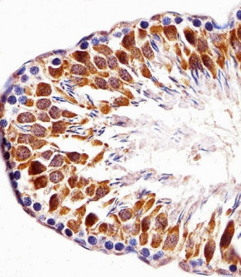 PBK Antibody / TOPK