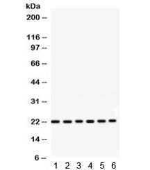 Western blot testing of 1) rat brain, 2) mouse thymus, 3) mouse brain, 4) human HeLa, 5) MCF7 and 6)