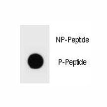 Phospho-TSC2 Antibody (pS1096)
