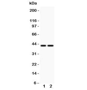 Western blot testing of CD244 antbody and Lane 1: human MCF-7; 2: human HeLa lysate.