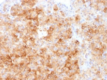 IHC analysis of FFPE human parathyroid gland stained with Chromogranin A antibody. Required HIER: st
