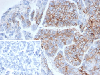 NCAM / CD56 Antibody