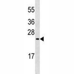 MUC1 Antibody