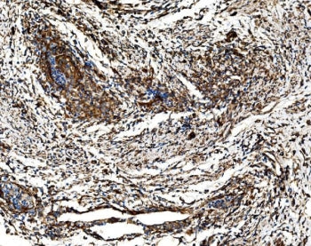 G3BP1 Antibody / Ras GTPase-activating protein-binding protein 1