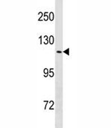 TRPV4 Antibody