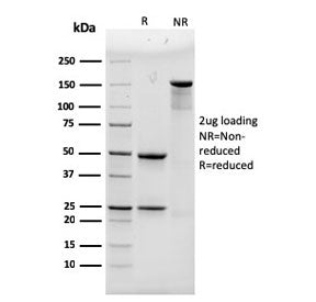 SDS-PAGE analysis of purified, BSA-free Alpha Actinin 4 antibody (clone 93) as confirmation of integ