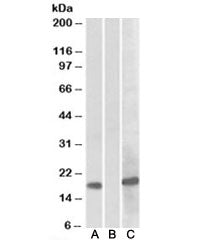 HEK293 lysate overexpressing human HOXA1-MYC probed with HOXA1 [1ug/ml] in Lane A and anti-MYC tag [