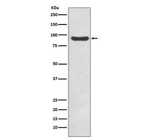 IKK beta Antibody / IKBKB