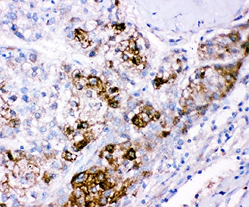 CBS Antibody