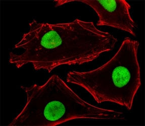 Fluorescent image of HeLa cells stained with SUMO-2 antibody at 1:25 dilution. An Alexa Fluor 488-co