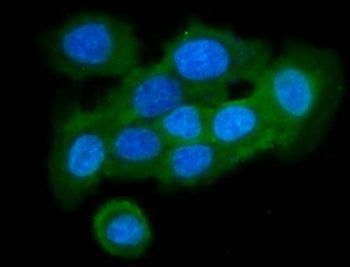 Immunofluorescent staining of FFPE human A431 cells with Cystatin B antibody (green) and DAPI nuclea