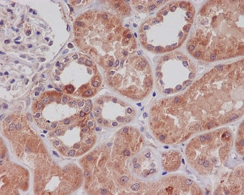 TLR2 Antibody
