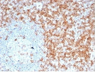 IHC staining of FFPE human tonsil tissue with recombinant CD5 antibody (clone C5/6463R). HIER: boil 