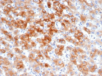 IHC staining of FFPE human colon tissue with recombinant Keratin 8 antibody (clone KRT8/6472R). HIER