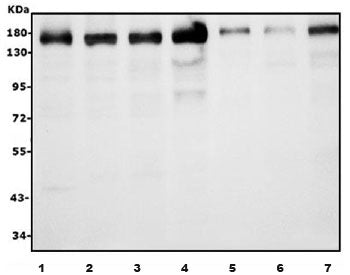 AFF4 Antibody / AF4/FMR2 family member 4