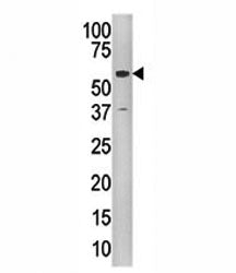 Tip60 Antibody