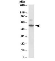 Western blot testing of rat colon lysate with Peripherin antibody at 0.1ug/ml. Expected molecular we