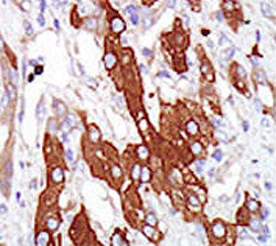 SGK3 Antibody / Serine/threonine-protein kinase Sgk3