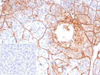 IHC staining of FFPE human pancreas tissue with COL4A5 antibody (clone COL4A5/9396R). Inset: PBS use