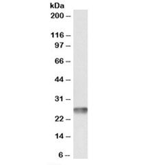 MT-ATP6 Antibody