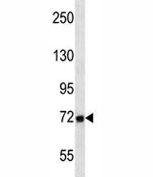 MMP2 antibody western blot analysis in T47D lysate. Expected molecular weight: ~72 kDa (pro form), ~