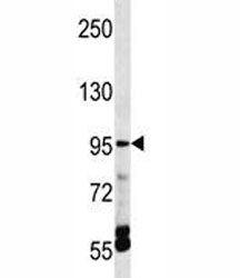 TRPV5 Antibody