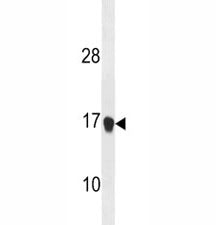 Anti-p21 antibody western blot analysis in mouse NIH3T3 lysate