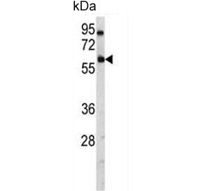 Western blot testing of human A2058 cell lysate with USP14 antibody. Predicted molecular weight ~56 