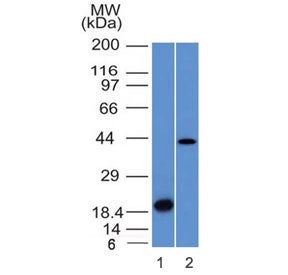 Western blot testing of 1) a partial recombinant protein and 2) human liver lysate with Aurora B ant